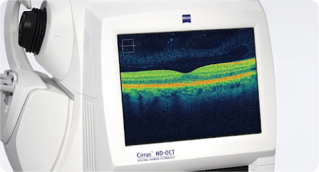 Tomografia de Coerência Óptica